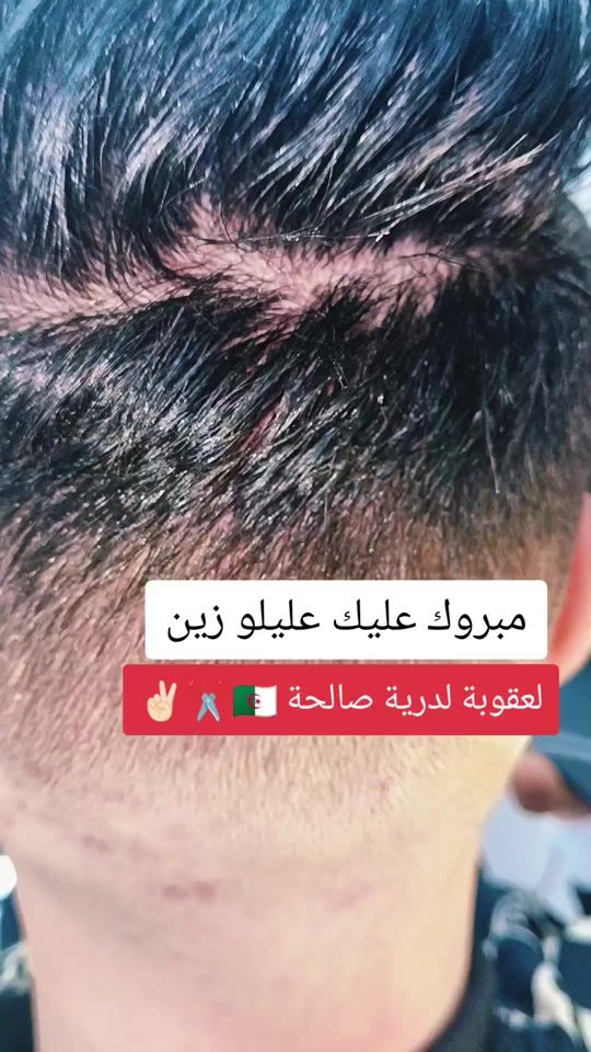 TikTok video thumbnail by houssame__18