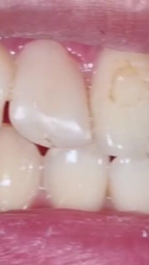 TikTok video thumbnail by dr_of_smile_
