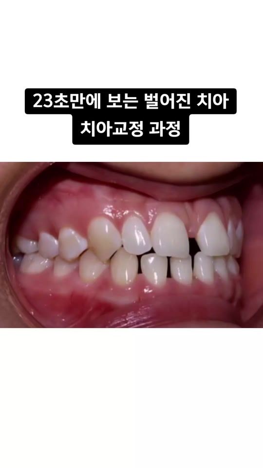 TikTok video thumbnail by misodream_dr