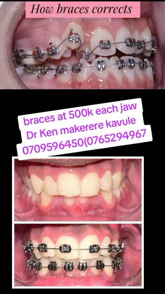 TikTok video thumbnail by kenny25dr