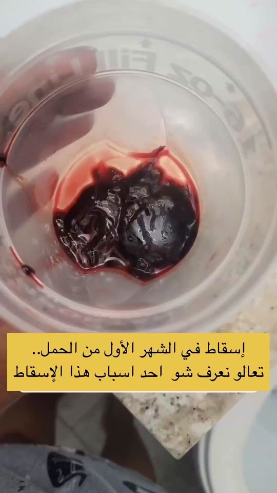 TikTok video thumbnail by drhusseinhammad