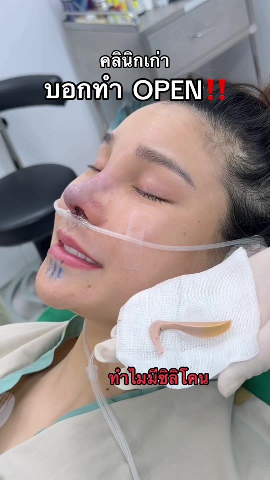 TikTok video thumbnail by lenistaclinic