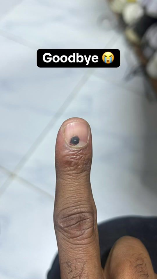 TikTok video thumbnail by kin_ja2