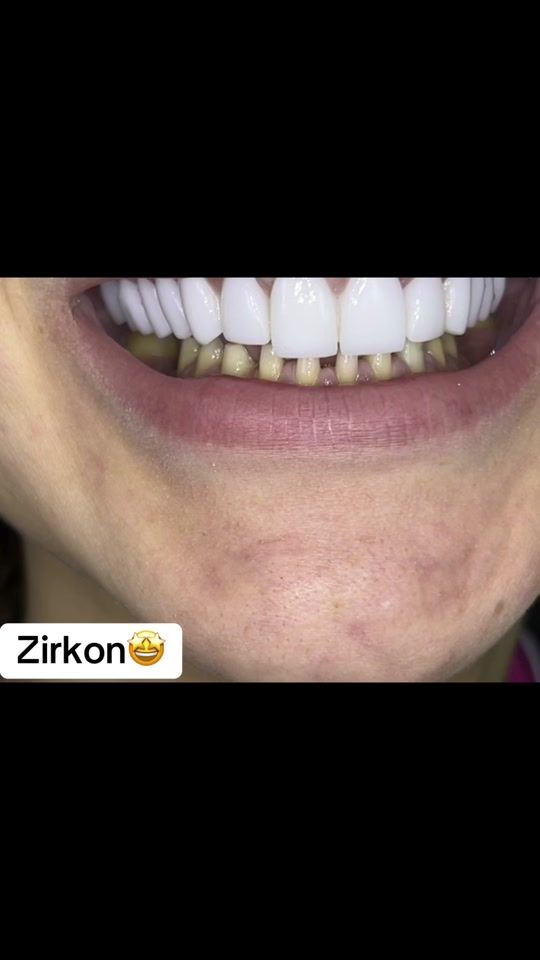 TikTok video thumbnail by stomatoloq.xalidd