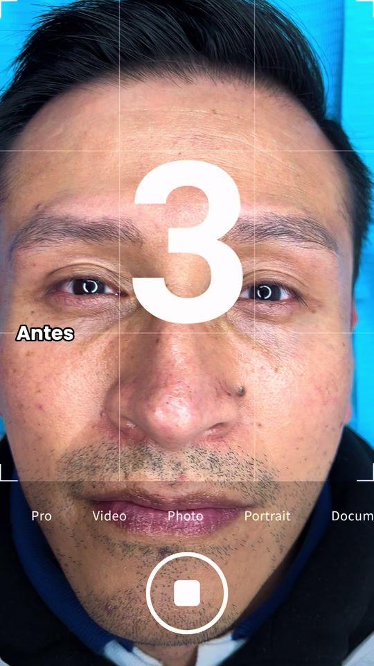 TikTok video thumbnail by masami_microlab