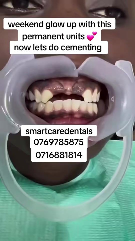 TikTok video thumbnail by smartcaredentalsnairobi