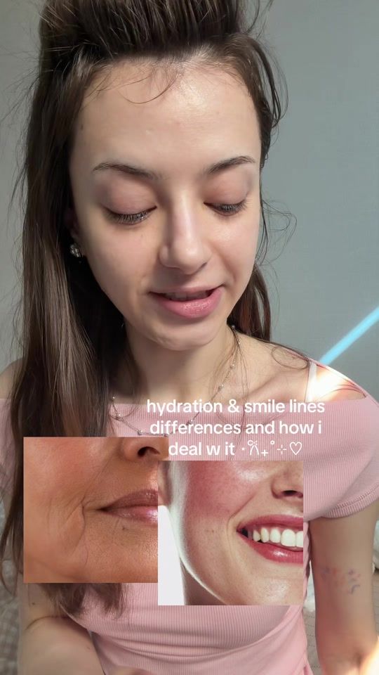 TikTok video thumbnail by anrinue