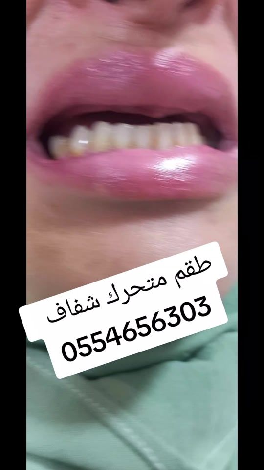 TikTok video thumbnail by uservz0srcxr6c