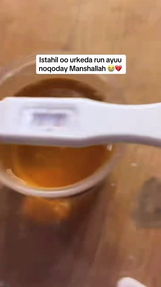 TikTok video thumbnail by 1like_ahmey2