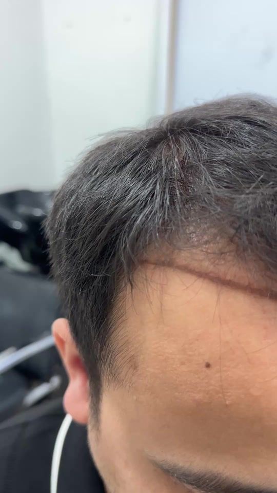 TikTok video thumbnail by dr_narzullayevich_