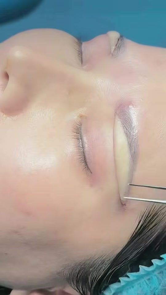 TikTok video thumbnail by dr.hung89