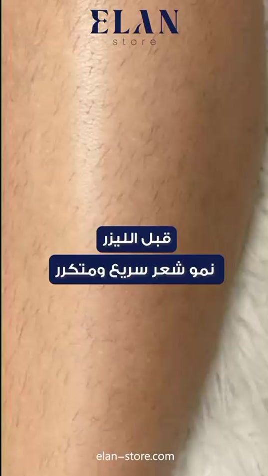 TikTok video thumbnail by eilan_store