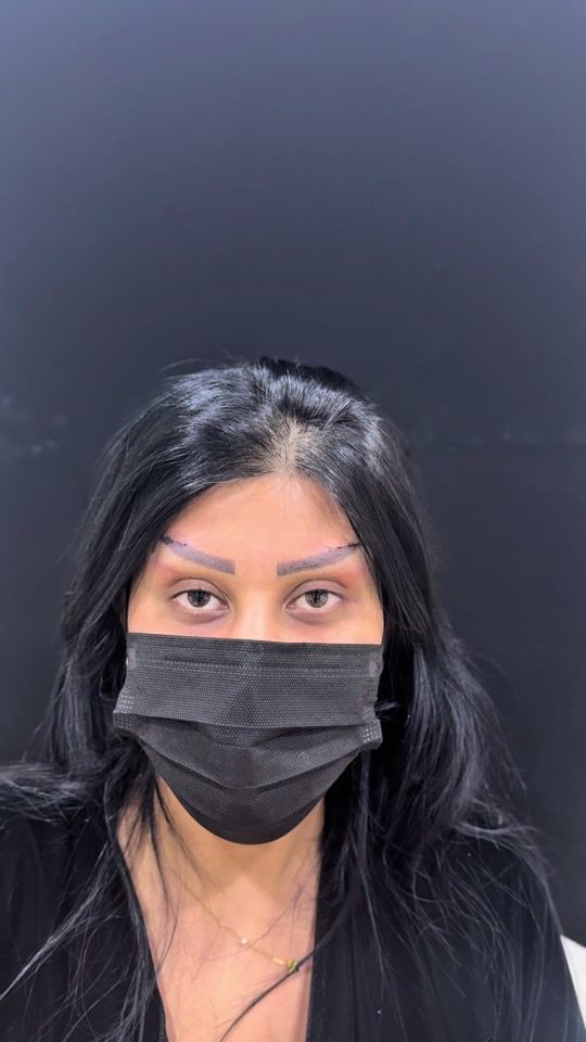 TikTok video thumbnail by dr.hersh83