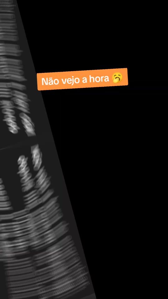 TikTok video thumbnail by delfazelito81