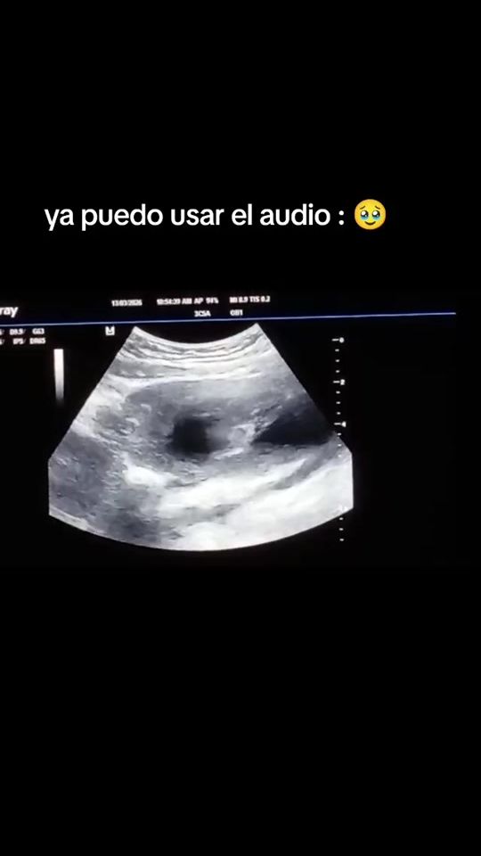 TikTok video thumbnail by alexguti20_32.com_