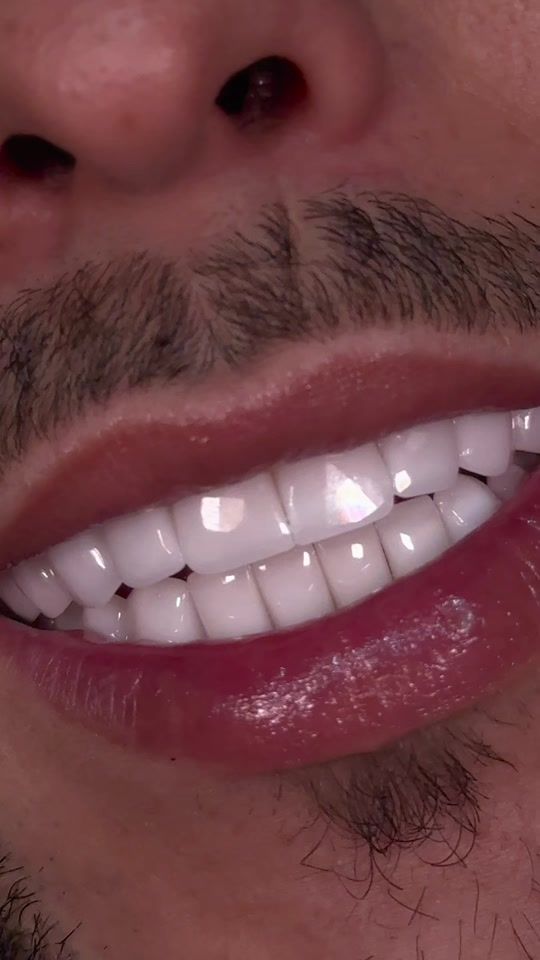 TikTok video thumbnail by drjuanlamadridoficial