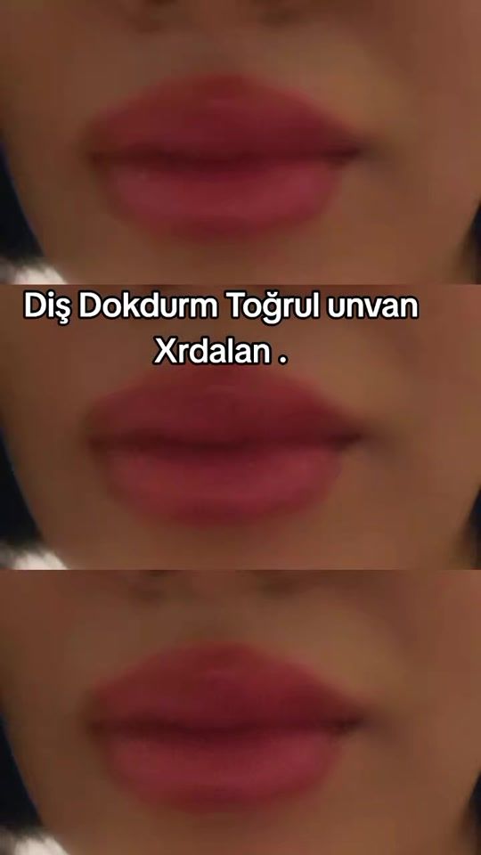 TikTok video thumbnail by partiyas