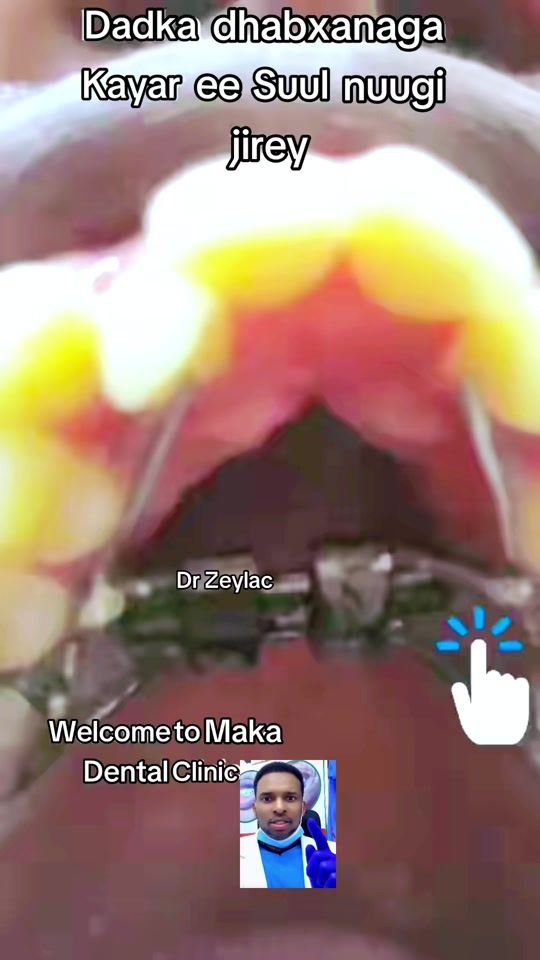 TikTok video thumbnail by dr_zeylac_1