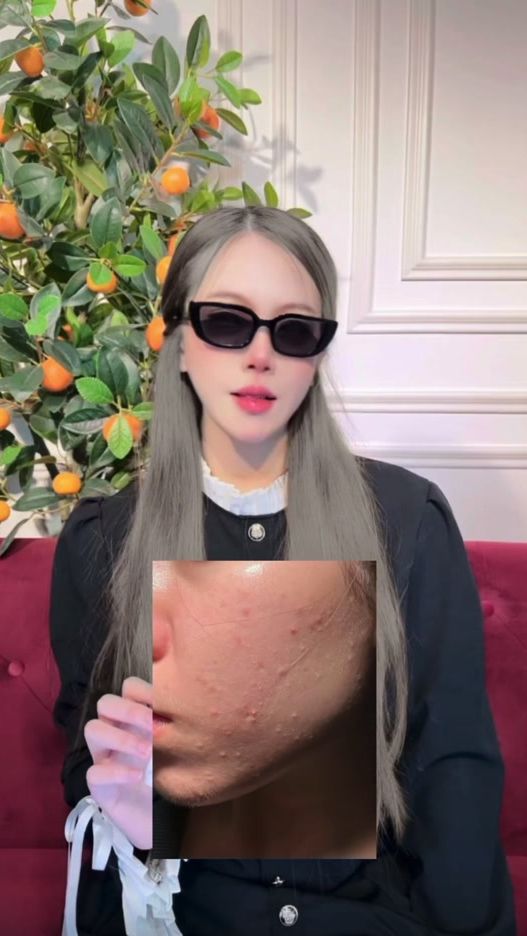 TikTok video thumbnail by _phatchayamon
