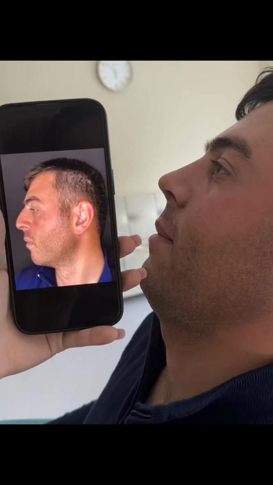 TikTok video thumbnail by dr.qahraman