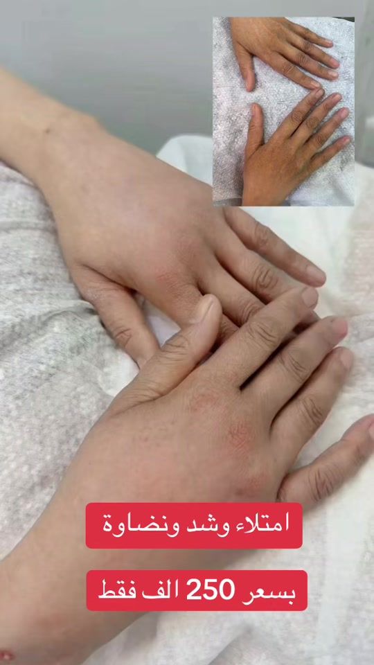 TikTok video thumbnail by po_dp90