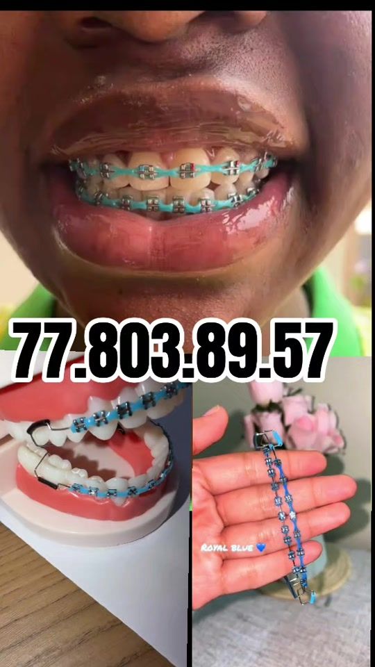 TikTok video thumbnail by a.b.n.officiel