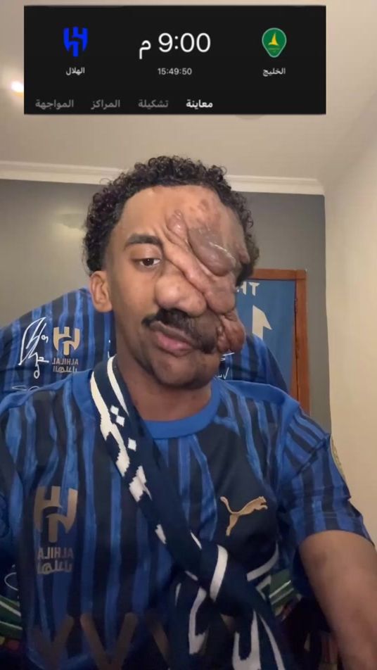 TikTok video thumbnail by ss_mm777