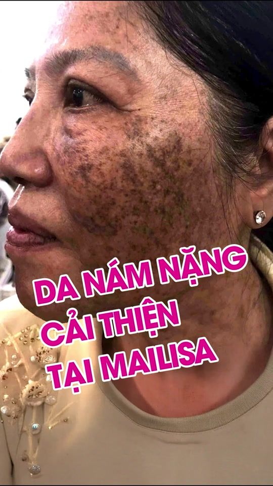 TikTok video thumbnail by leduyenmailisa