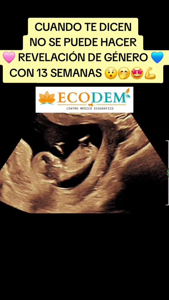 TikTok video thumbnail by ecodem_centro_ecografico