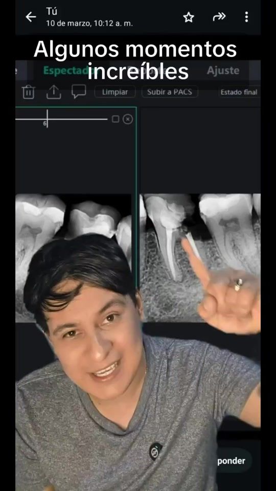 TikTok video thumbnail by dientologo