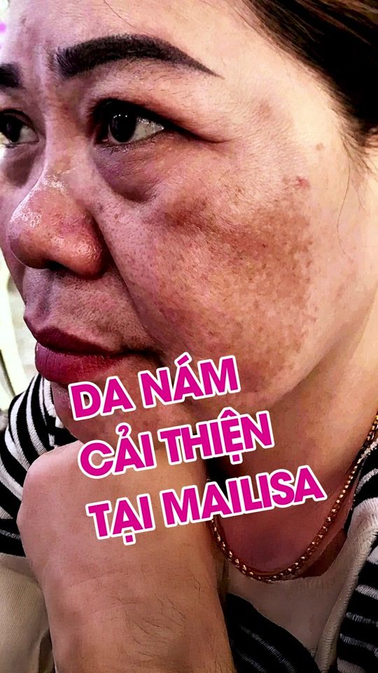 TikTok video thumbnail by mailisa_group