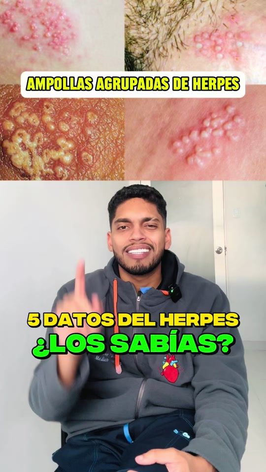 TikTok video thumbnail by eldralvaro