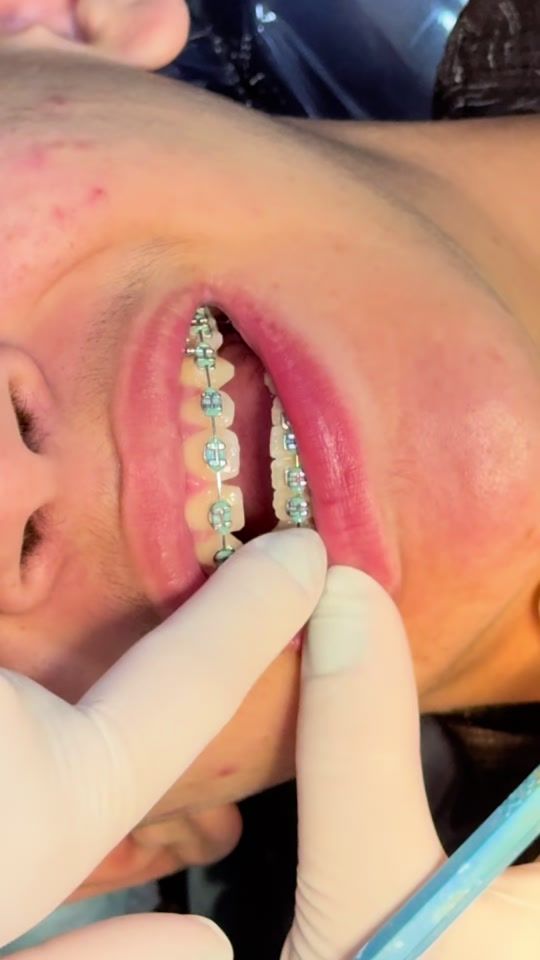 TikTok video thumbnail by dramonicapinheiro