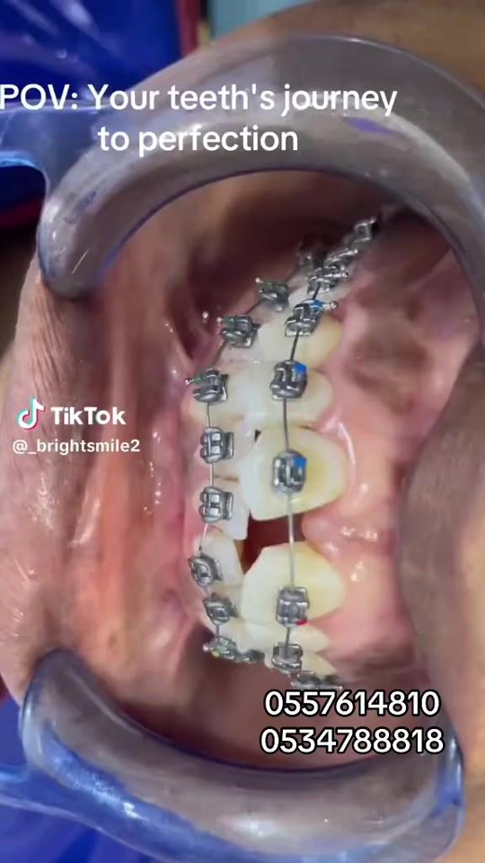 TikTok video thumbnail by abena_tompodie