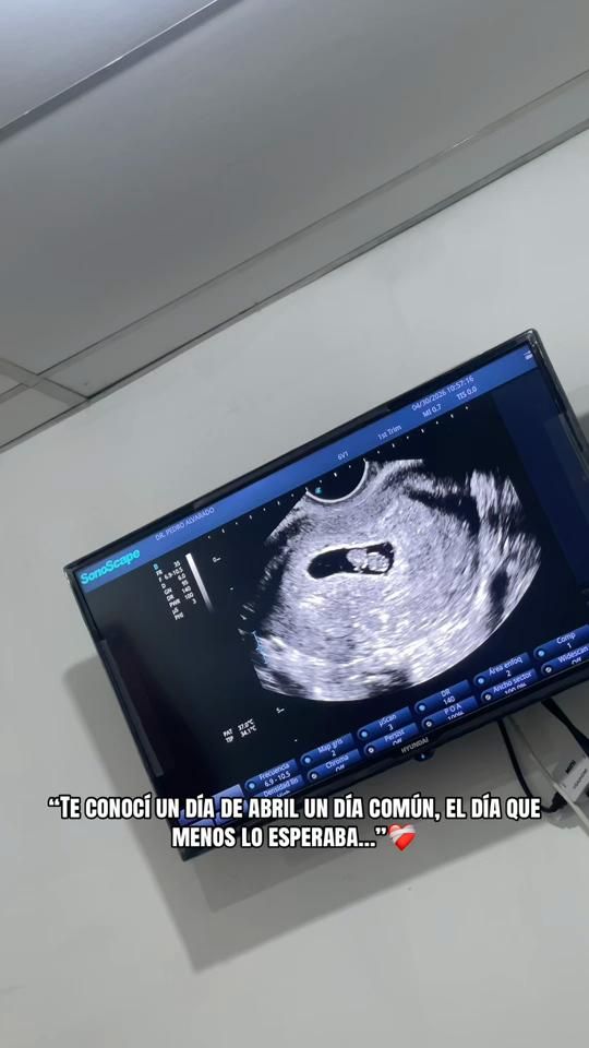 TikTok video thumbnail by requenanic