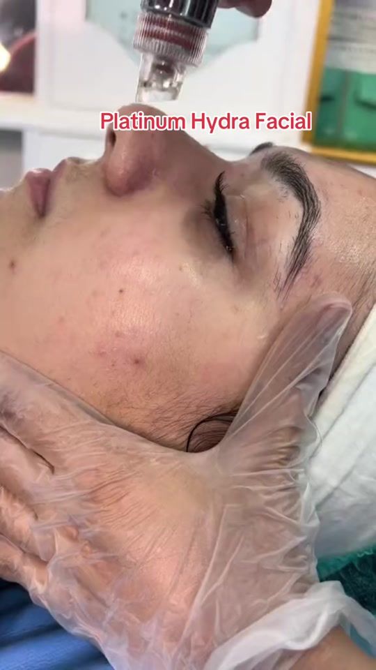 TikTok video thumbnail by sunainans_beauty_zone