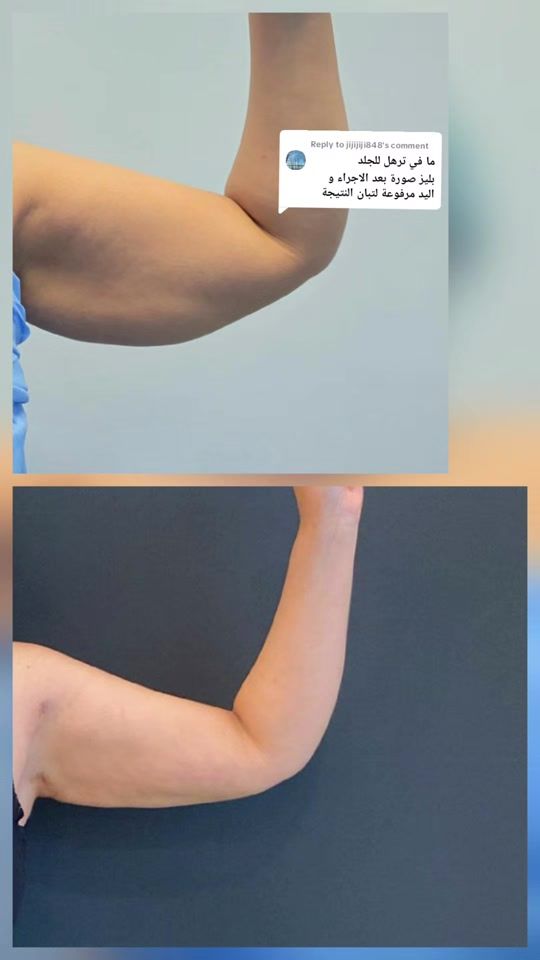 TikTok video thumbnail by doctormosalah11