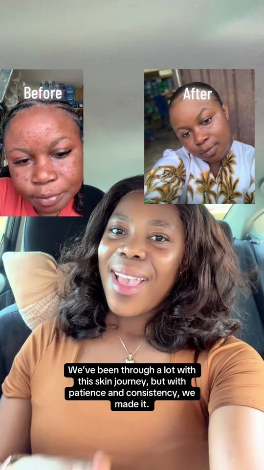 TikTok video thumbnail by .piele.hermosa.cosmetics