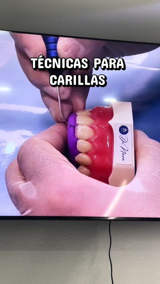 TikTok video thumbnail by dentologa_