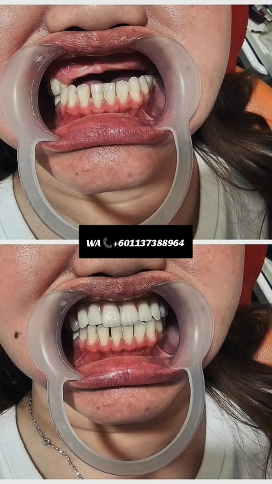 TikTok video thumbnail by ginsulmaniss