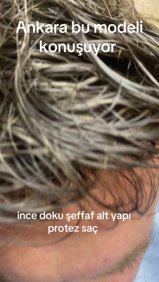 TikTok video thumbnail by m.aydn006