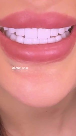 TikTok video thumbnail by dentist.anar