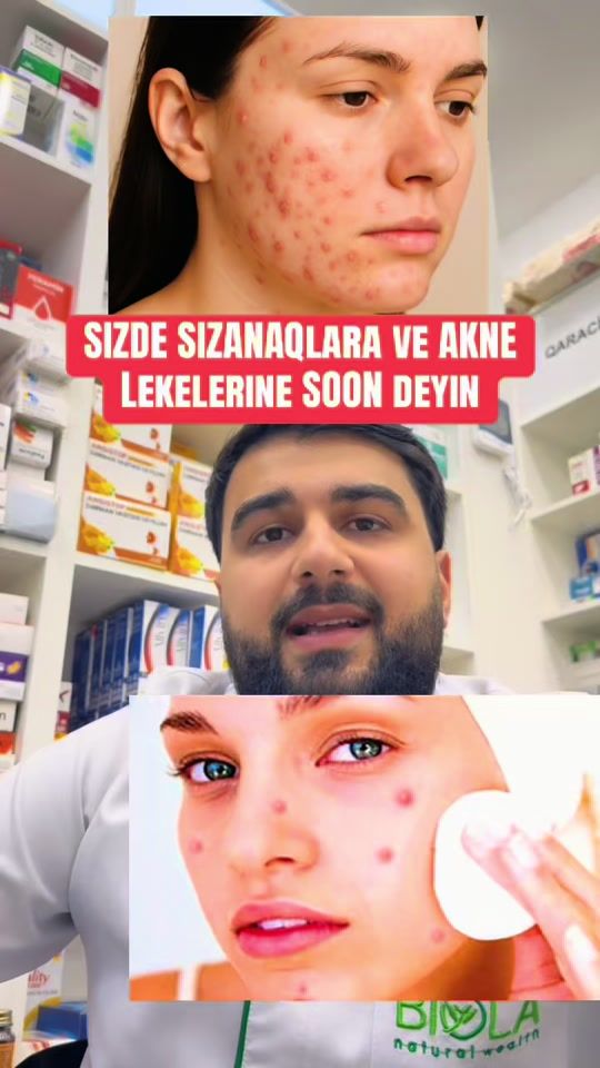 TikTok video thumbnail by vagif_292