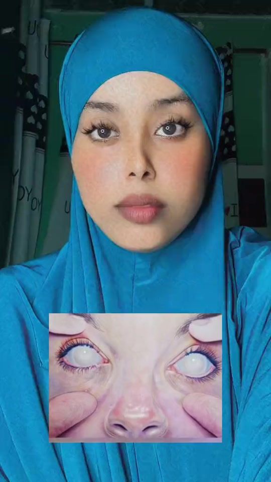 TikTok video thumbnail by ahlaammohan