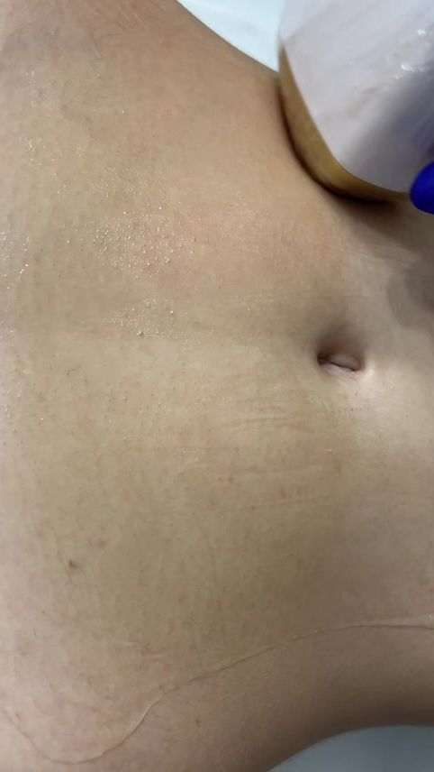 TikTok video thumbnail by epil_studio