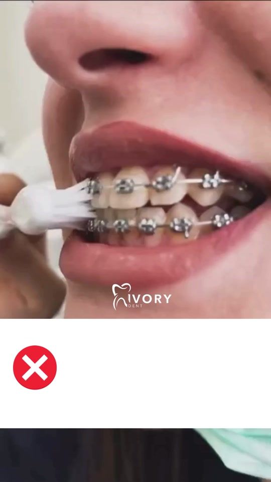 TikTok video thumbnail by ivorydenttirana