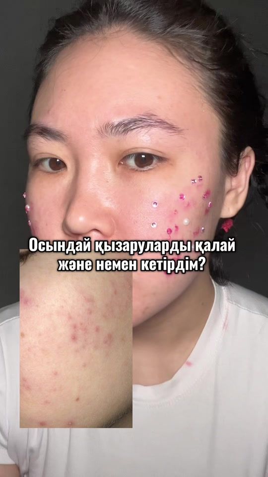 TikTok video thumbnail by granattok