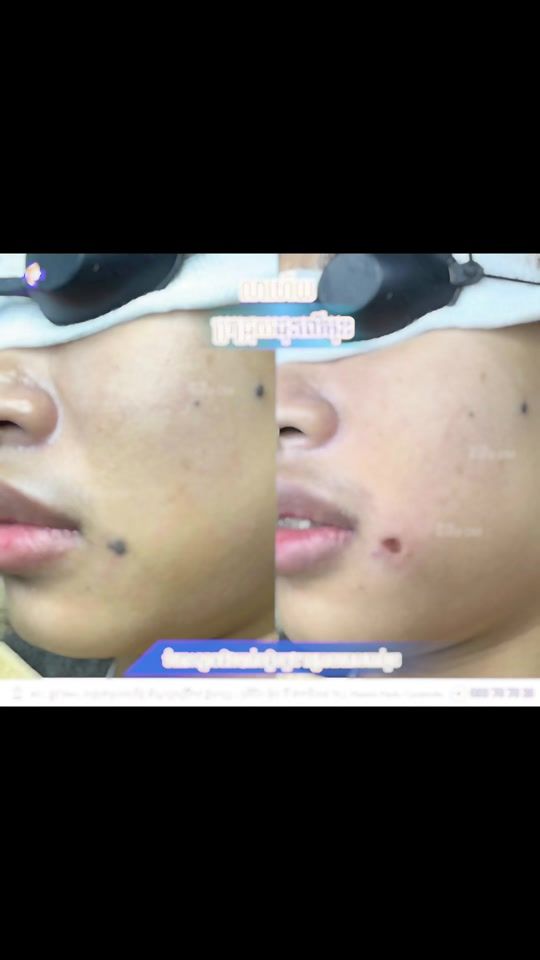 TikTok video thumbnail by dermato_med