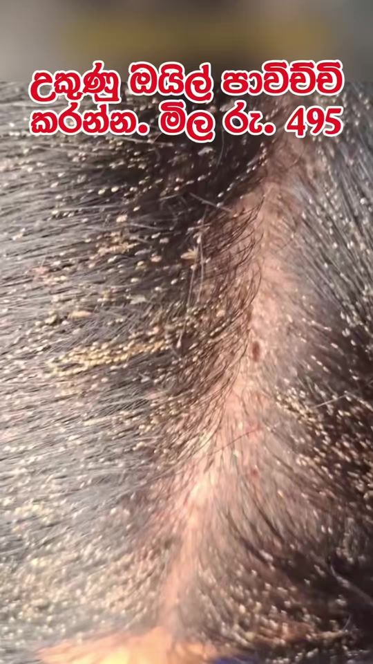 TikTok video thumbnail by lassana_rahas