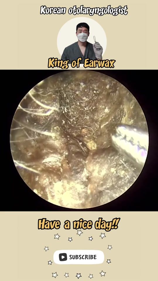 TikTok video thumbnail by king_of_earwax